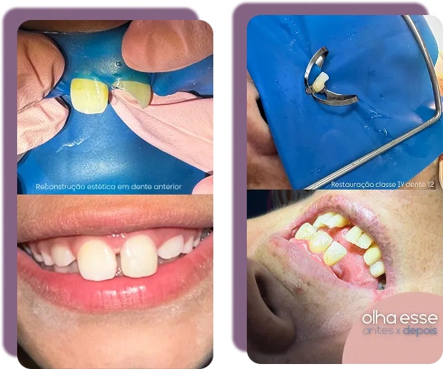 Antes e depois de procedimentos